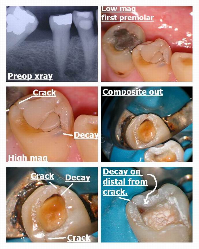 Resize of Occlusal page 1.jpg